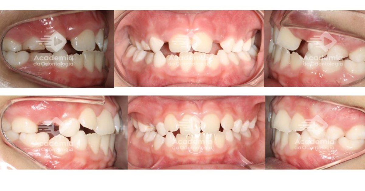 Odontologia em Expansão em Goiás