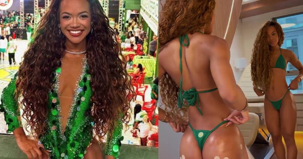 Rainha da Mocidade faz segundo preenchimento no bumbum e mostra resultado