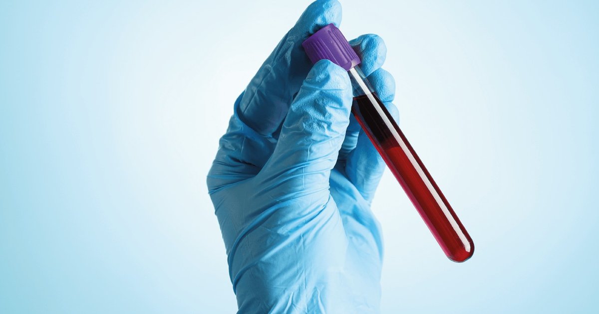 Exame de sangue para Alzheimer avança e pode chegar à rede pública de Goiás