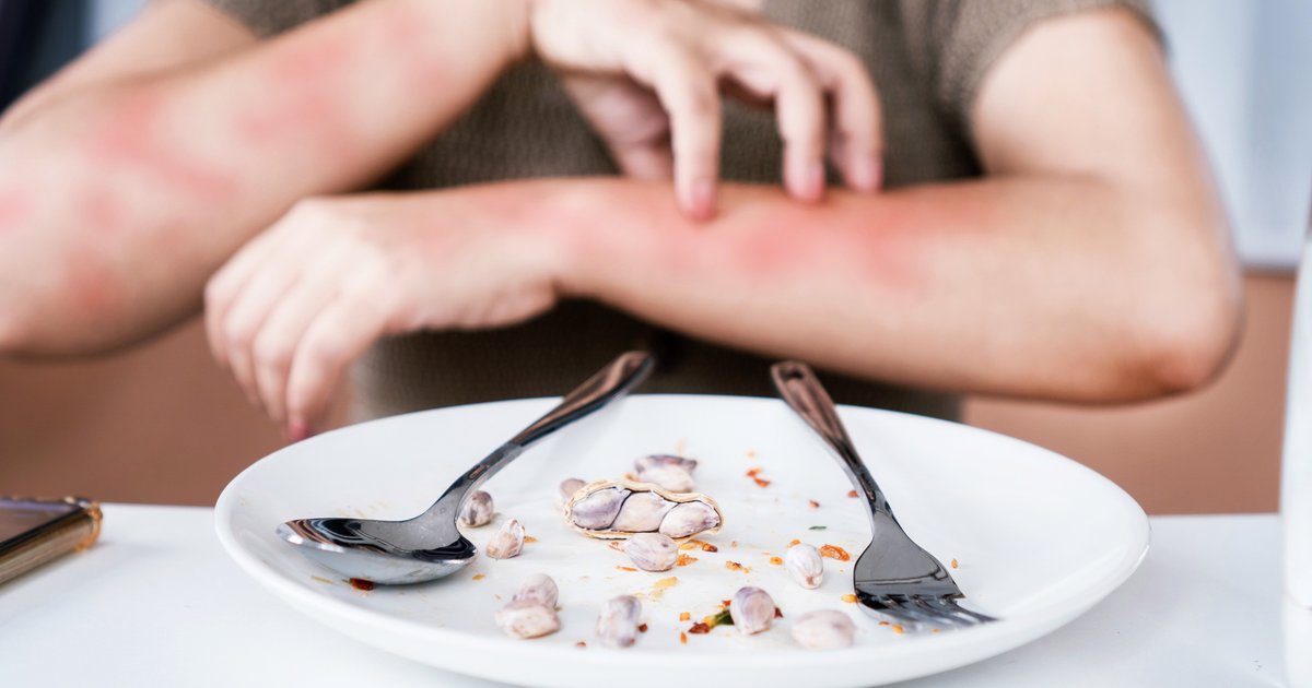 Alergias alimentares causaram quase 500 mortes no Brasil desde 2022