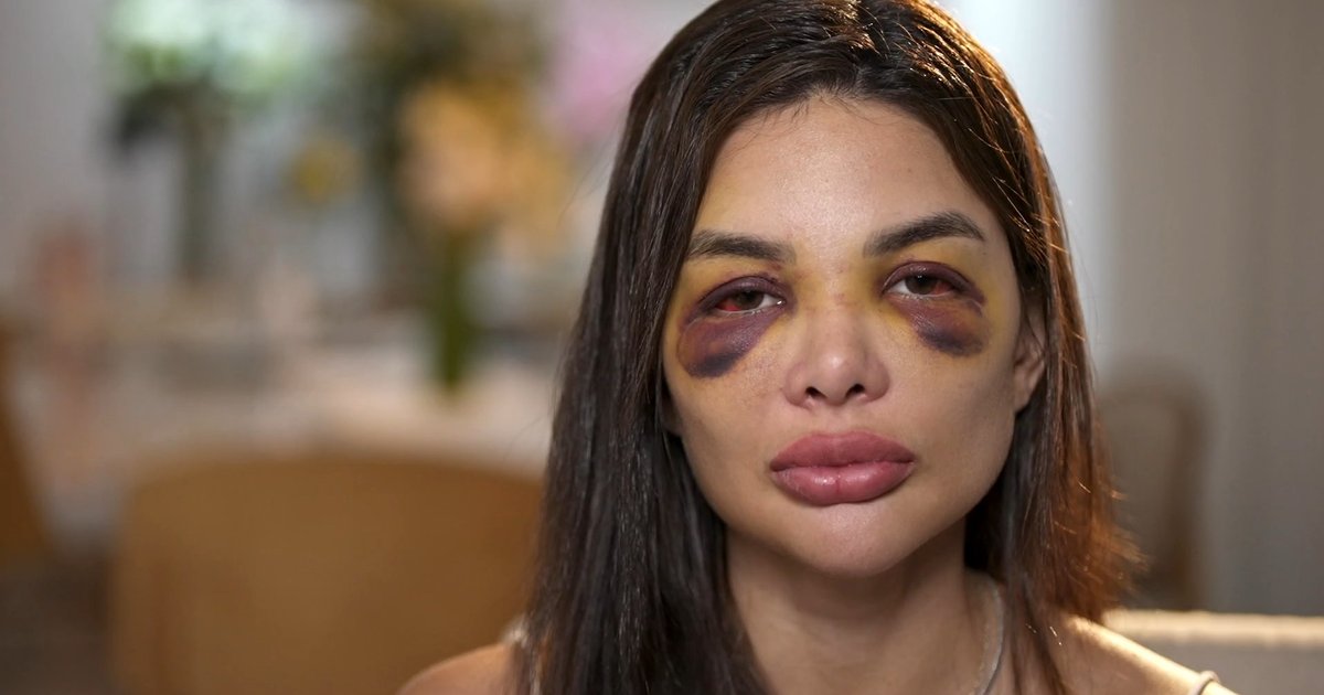 Mulheres levam mais de dez anos para romper ciclos de violência doméstica