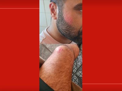 Eleitor é agredido com soco após fazer gesto político em praça do Guará durante votação