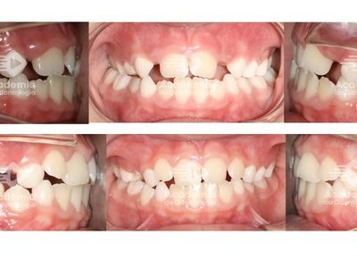 Odontologia em Expansão em Goiás