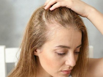 Queda capilar feminina: cafeína tópica alemã chega ao Brasil como alternativa na dermatologia
