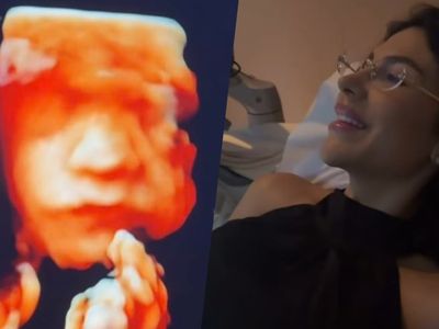 Arthur Aguiar compartilha ultrassom do terceiro filho nas redes sociais