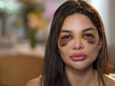 Mulheres levam mais de dez anos para romper ciclos de violência doméstica